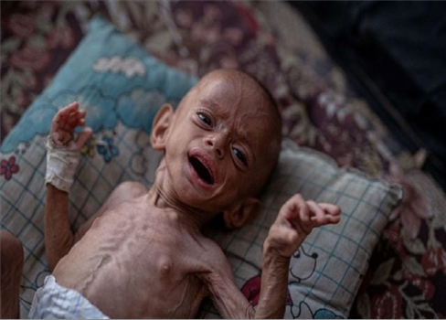 وزارة الصحة في غزة .. 710 رضع استشهدوا نتيجة العدوان الإسرائيلي