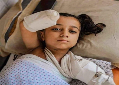 بسبب الحرب على غزة..  10 آلاف حالة إعاقة نصفها على الأقل من الأطفال